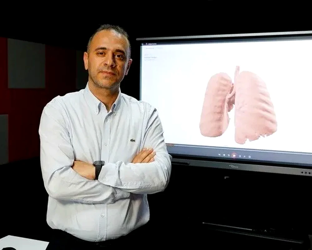Akciğer kanseri tanısında doktorlara "ikinci göz" olacak sistem - Dosya Haber