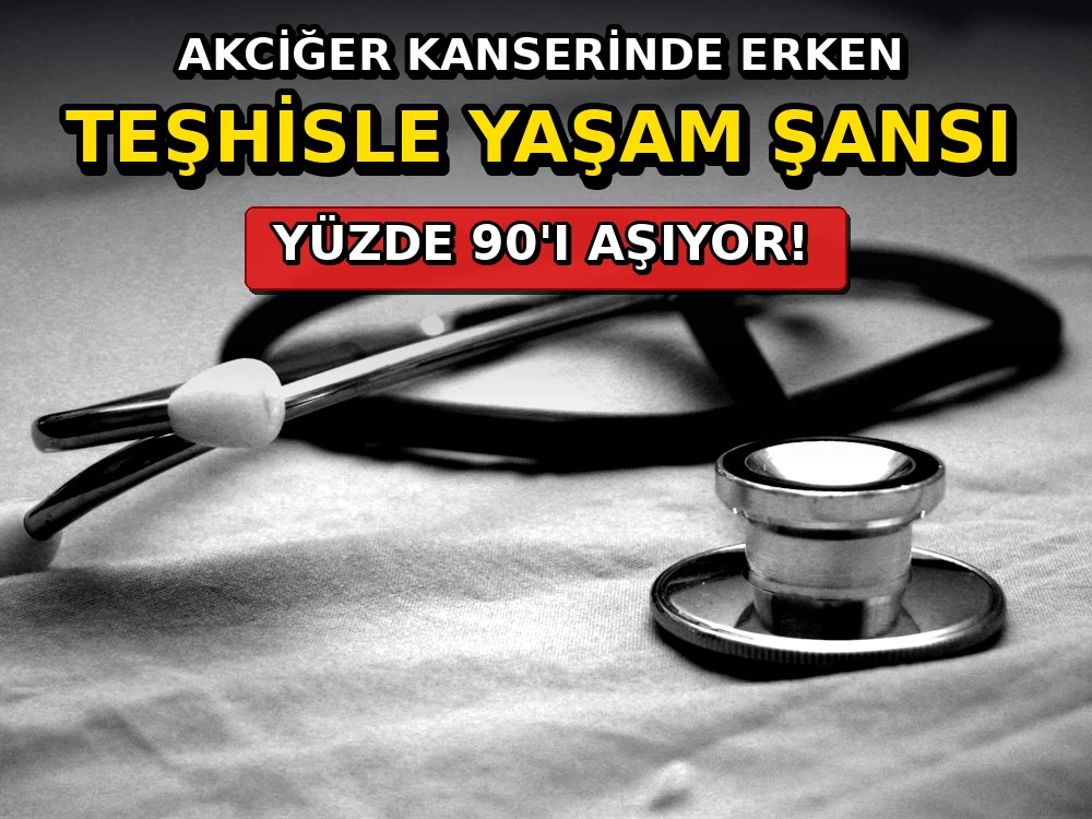 Akciğer kanserinde erken teşhisle yaşam şansı yüzde 90'ı aşıyor - Dosya Haber Manşet